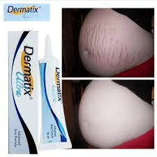 Ảnh Kem hỗ trợ trị sẹo Dermatix 15g